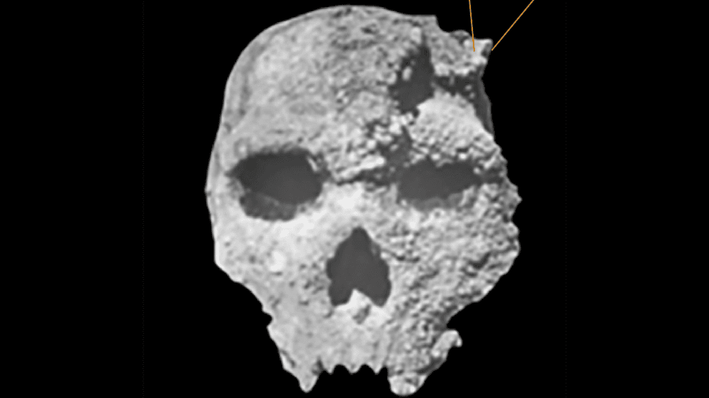 Hominin skull discovered in 1960 finally gets an accurate age