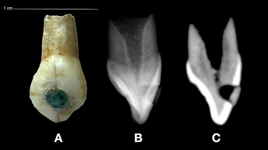 Jade gems decorated these Mayan kids' teeth