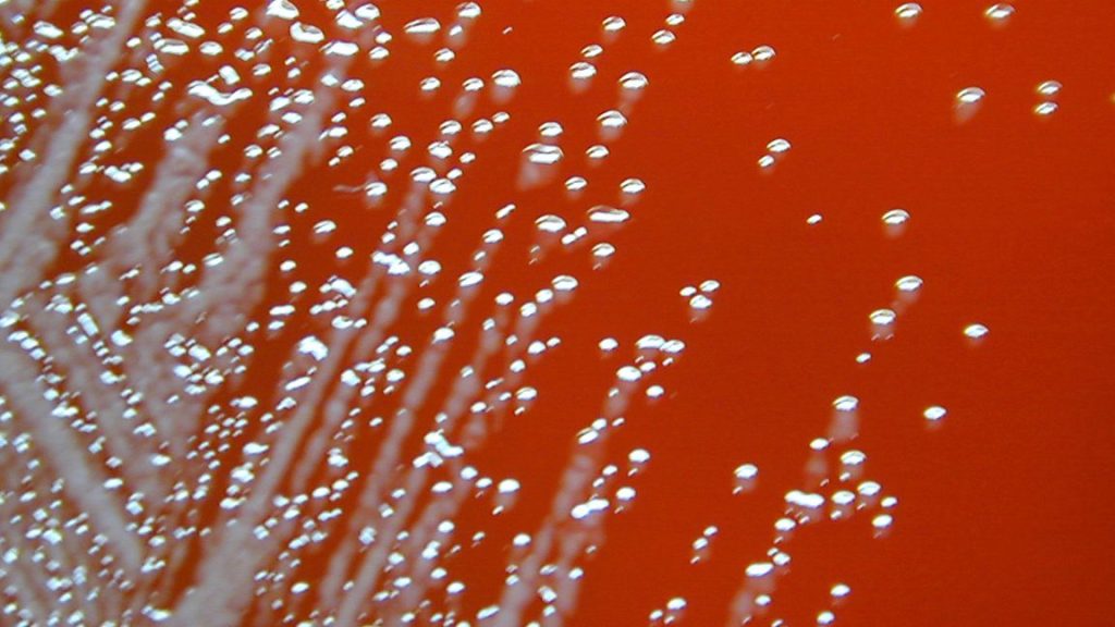 Extreme close-up photograph of white flecks growing in red blood.